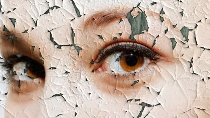 Moters akys ir suskilinėjusi veido oda – fotosenėjimo iliustracija